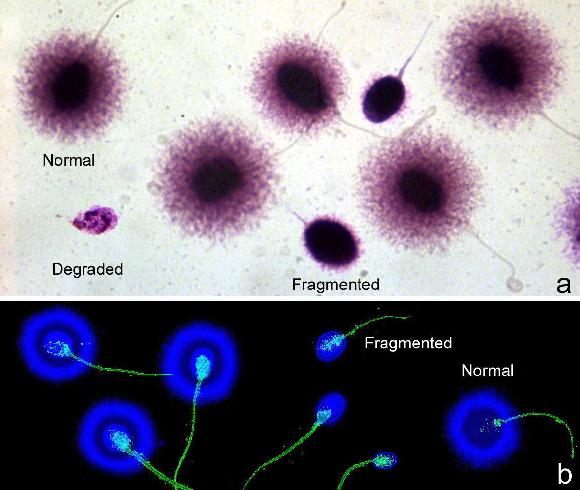 test SCD, zonas fragmentadas y normales